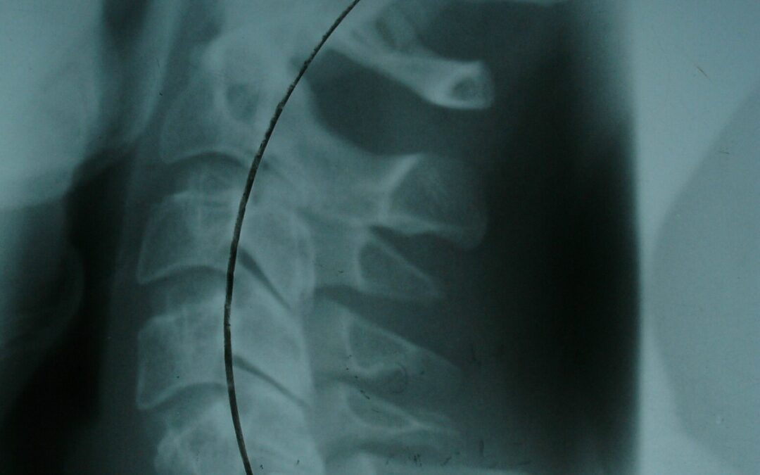 Chiropractic